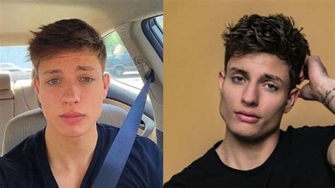 Matt Rife denies plastic surgery, explains why face changed